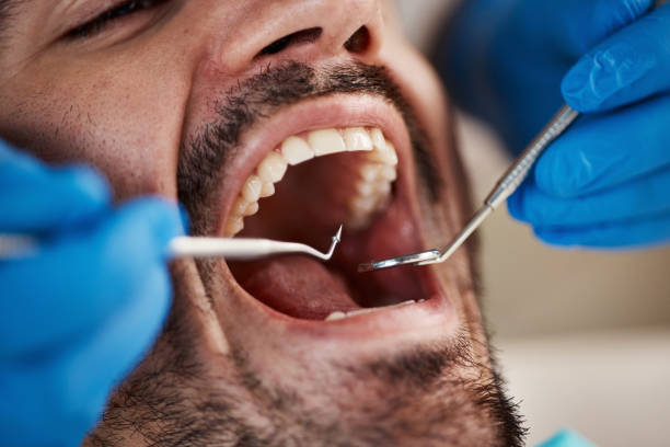 Best Emergency Gum Treatment in Maugansville, MD