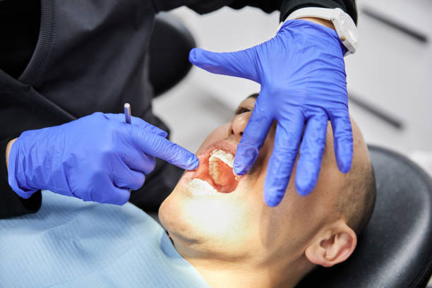 Best Emergency Root Canal Treatment in Maugansville, MD
