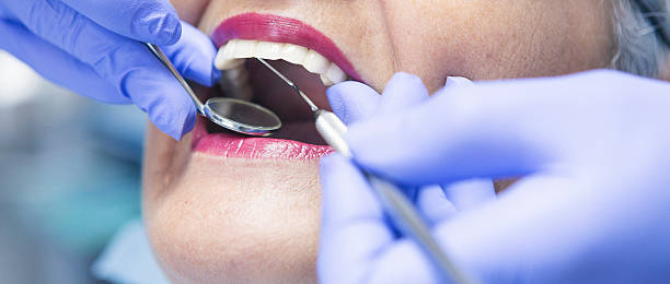 Best Emergency Dental Care for Broken or Chipped Teeth in Maugansville, MD